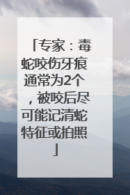 专家：毒蛇咬伤牙痕通常为2个，被咬后尽可能记清蛇特征或拍照